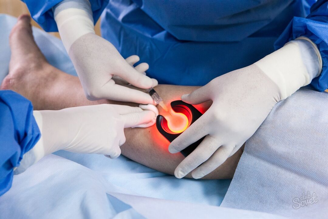 Jalade diagnostika veenilaiendid